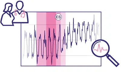 Temperaturkurve des weiblichen Zyklus - Ovularing Auswertung