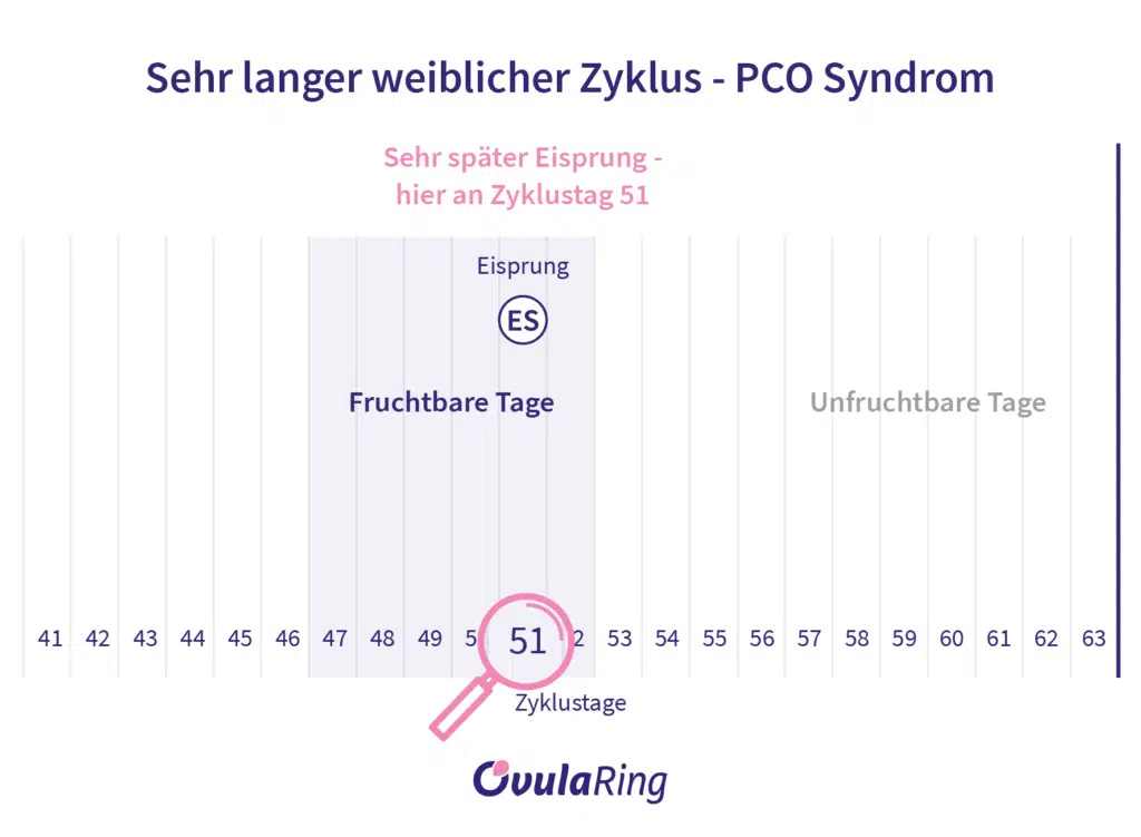 Sehr langer weiblicher Zyklus mit spätem Eisprung - PCO Syndrom