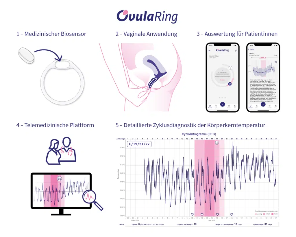 Die OvulaRing Methode - telemedizinische Plattform für eine moderne Zyklusdiagnostik