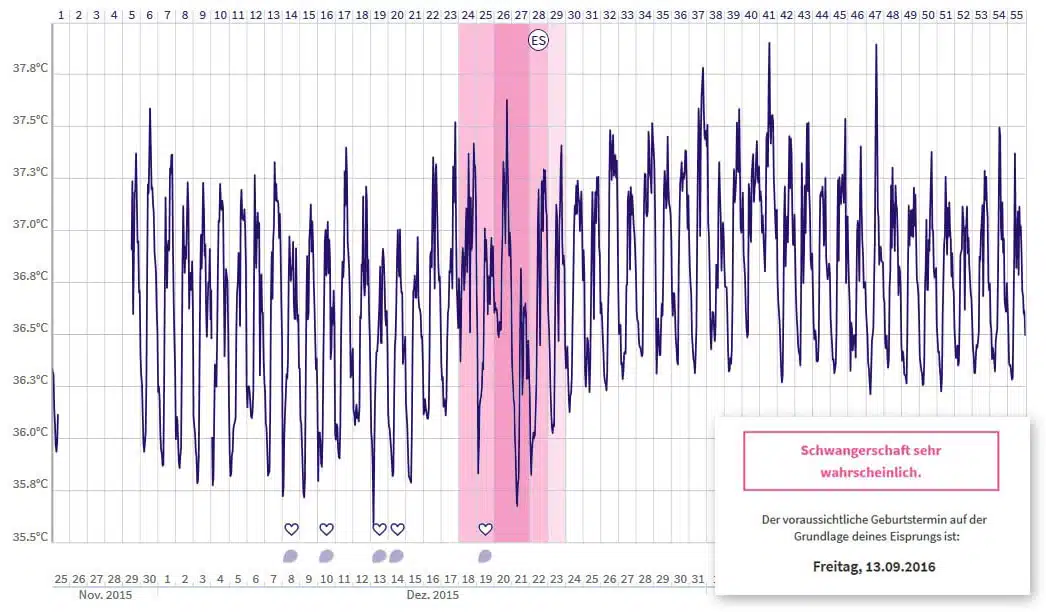 Anne Alexander - OvulaRing Erfahrungsbericht - schwanger werden mit dem medizinischen Zyklustracker